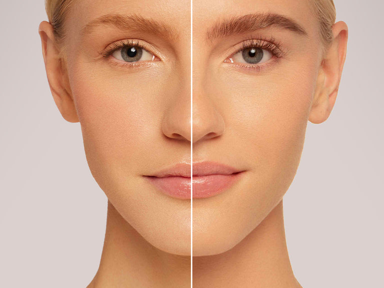 6 Reasons Why You May Be Experiencing Thinning Brows